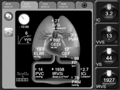 Volumen diastólico final global. Predictor de mortalidad en pacientes ...